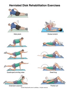herniated disc exercises